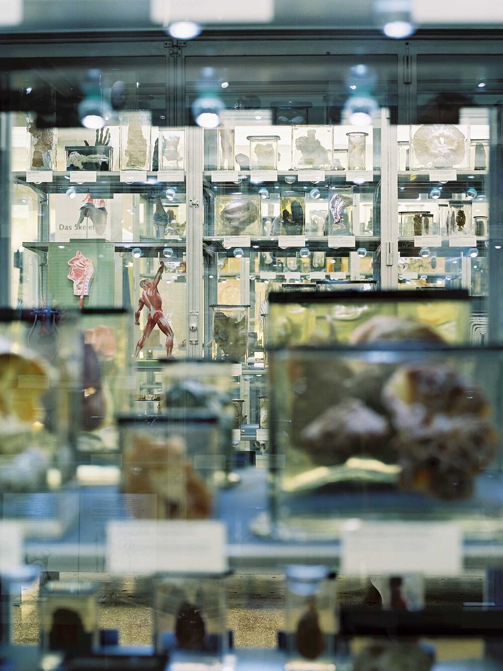 Berliner Medizinhistorisches Museum der Charité, Präparatevitrinen Dauerausstellung 